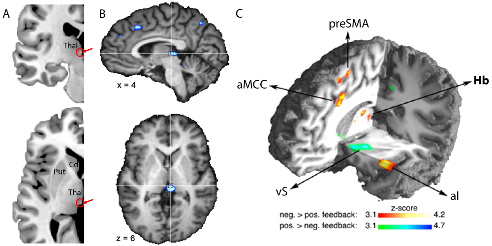 Figure of a brain